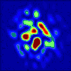 Quantum dynamics with x-ray speckle